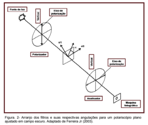 distribuição de tensões em implantes