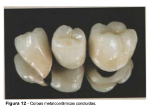 implantes de conexão sem parafuso