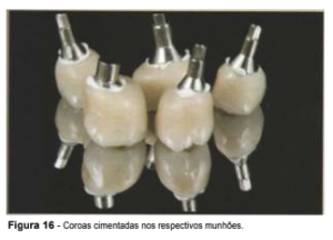 implantes de conexão sem parafuso