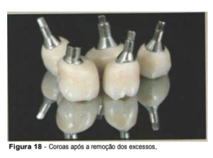 implantes de conexão sem parafuso