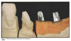 implantes de conexão sem parafuso