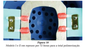 formatos das roscas dos implantes