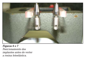 formatos das roscas dos implantes