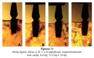 formatos das roscas dos implantes