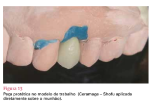 sistema de implante friccional