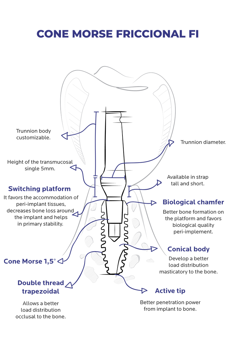 http://friccional%20II-implant