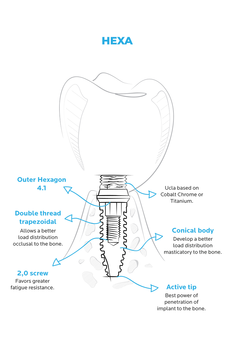 http://HEXA-implant