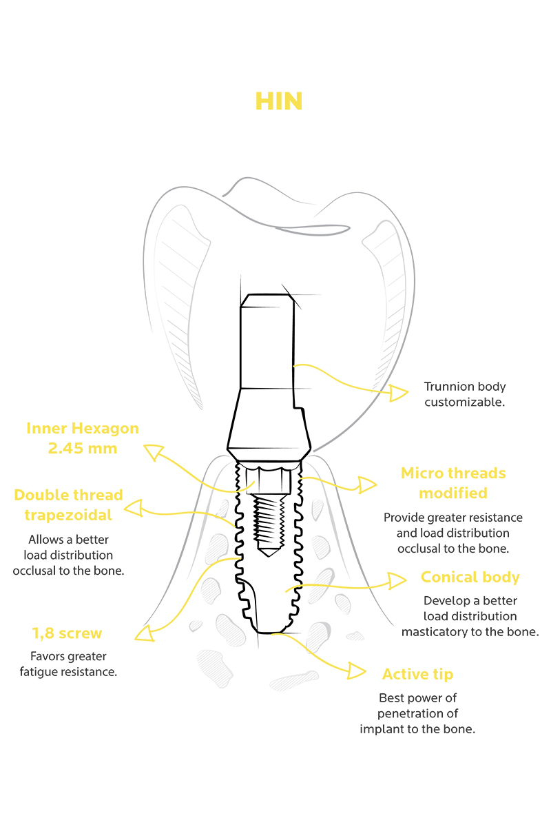 http://HIN_implant